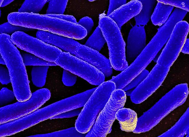 E. coli a miúdo desencadea o desenvolvemento de cistite nas mulleres